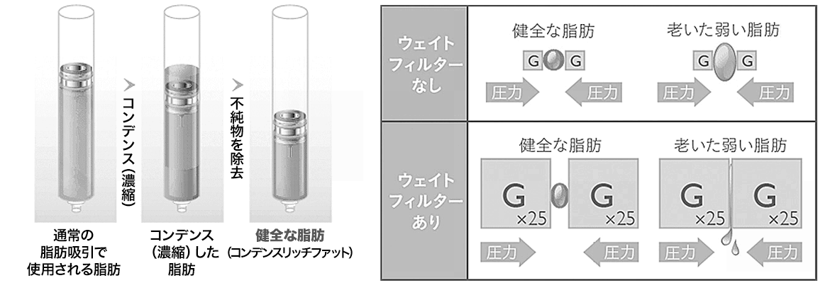 注入に最適な状態を生み出すトリプル・コンデンス処理