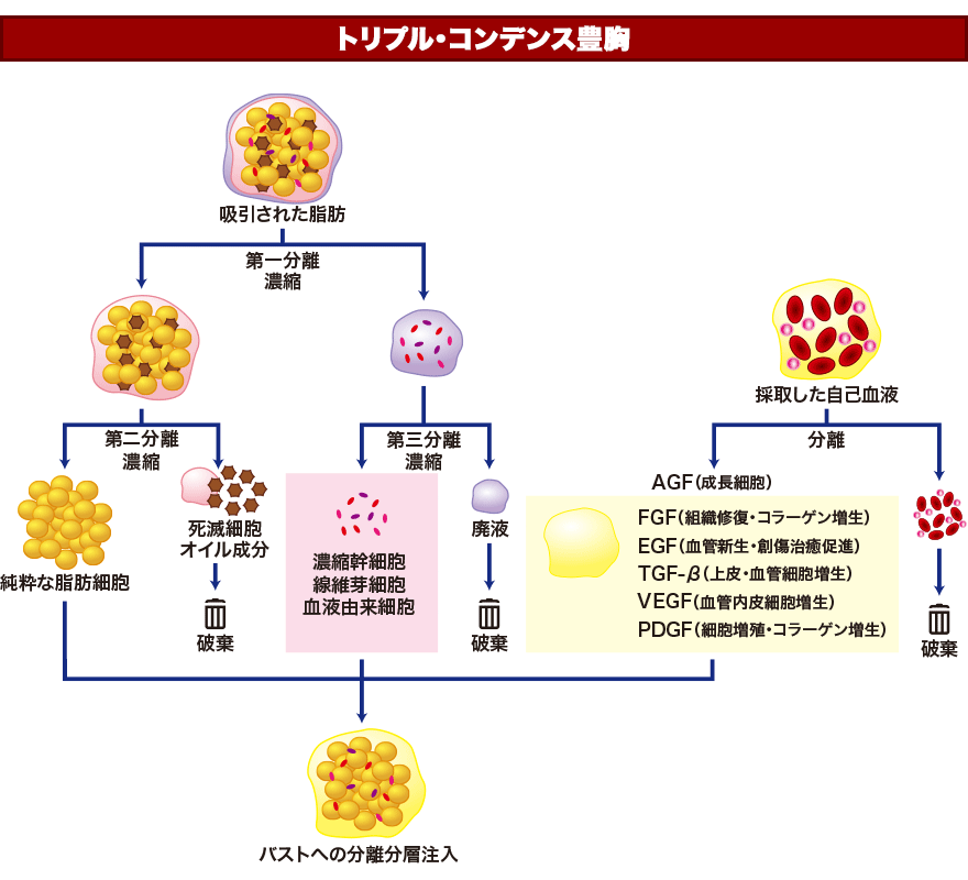 遠心分離器「LIPOMAX-SC」で不純物を分離