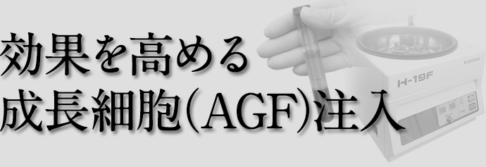 脂肪注入・ヒアルロン酸注入・アクアフィリング注入の修正手術も可能