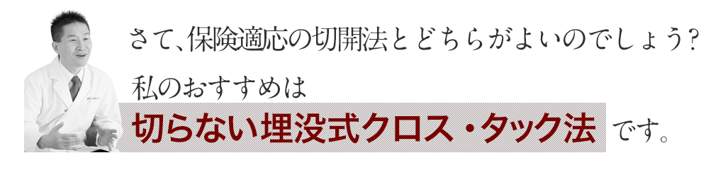 私のおすすめは切らない埋没式クロス・タック法です。