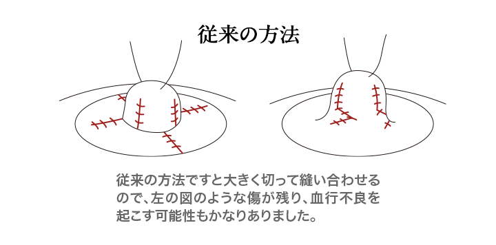 従来の方法